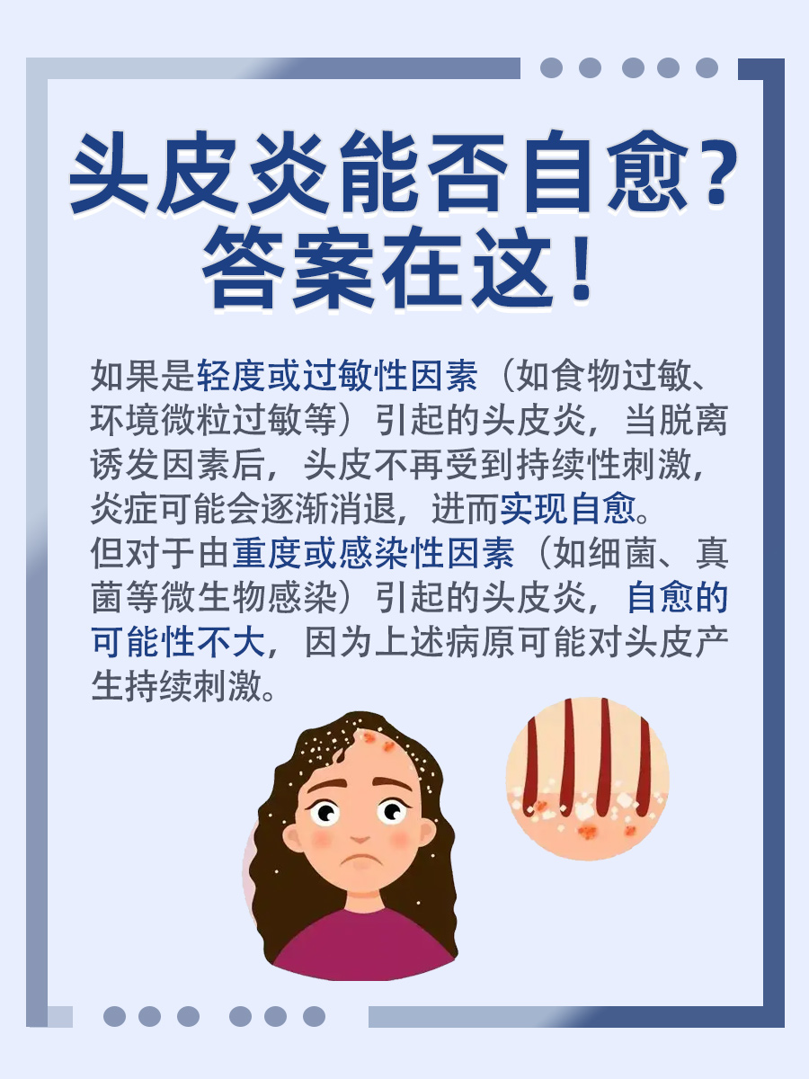 头皮炎能否自愈？听听医生怎么说