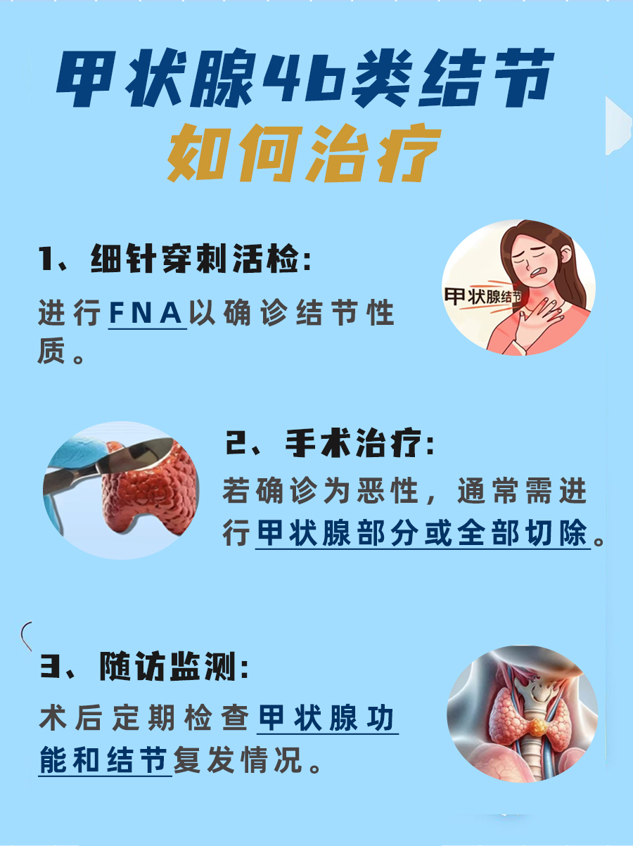 甲状腺4b结节:恶性风险高,需进一步诊断