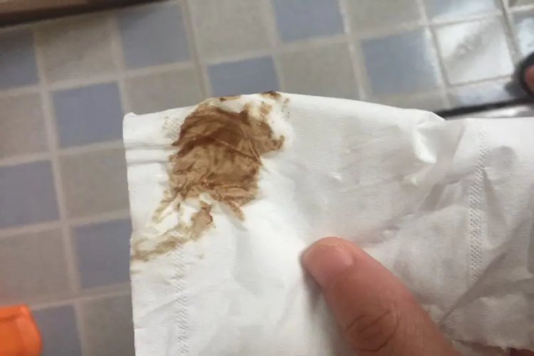 先兆流产流褐色分泌物图