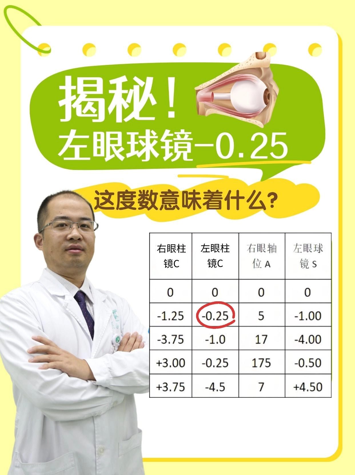 揭秘！左眼球镜-0.25，这度数意味着什么？