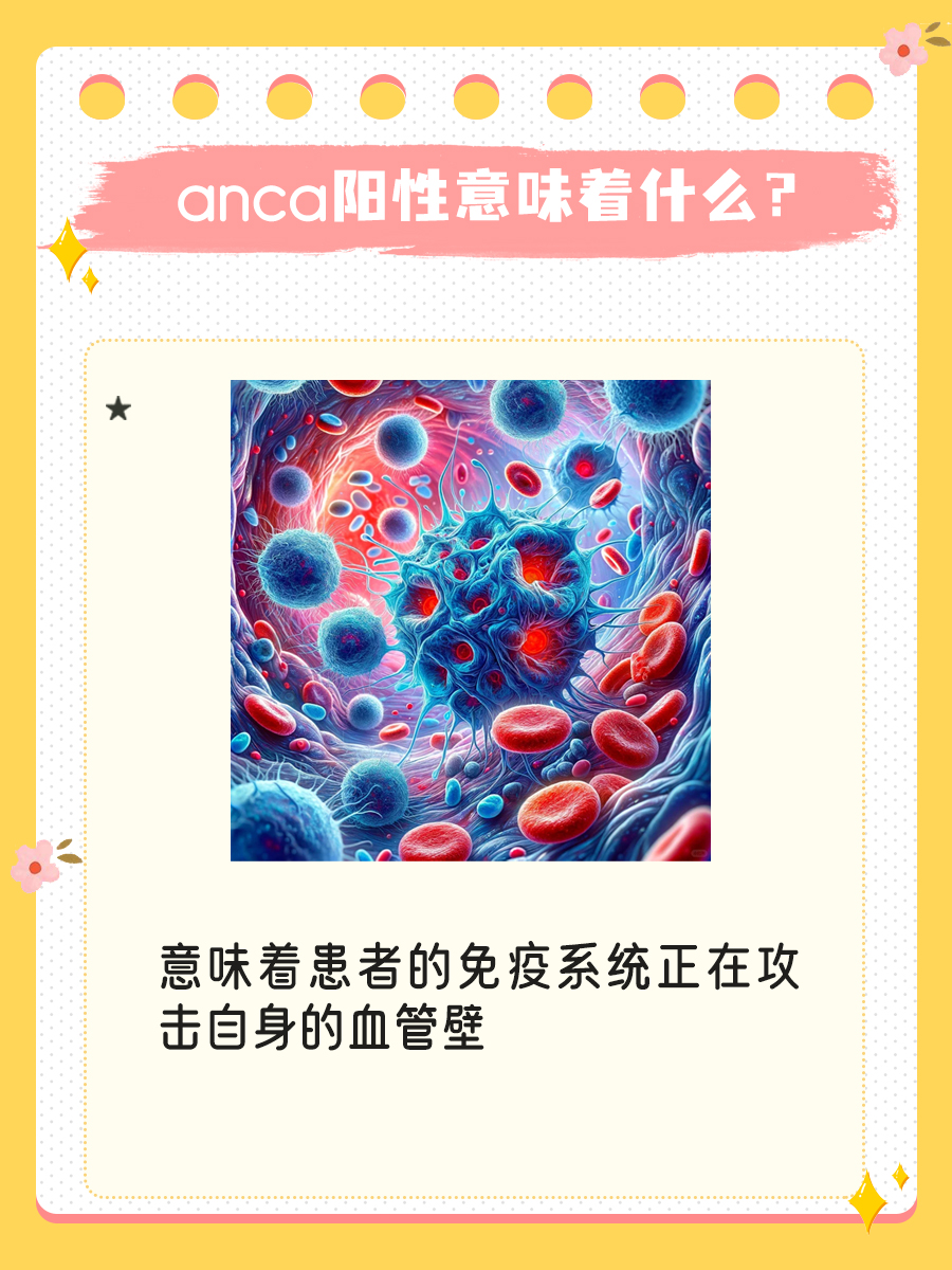 anca阳性预警：十之八九，需警惕！