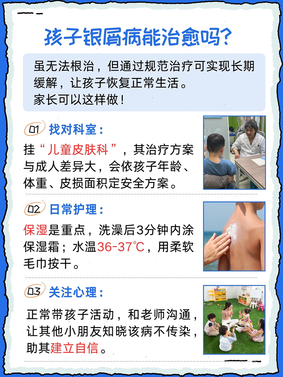 孩子银屑病是什么病，能治愈吗｜家长必看