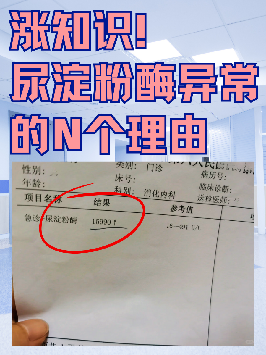 涨知识！尿淀粉酶异常的N个理由