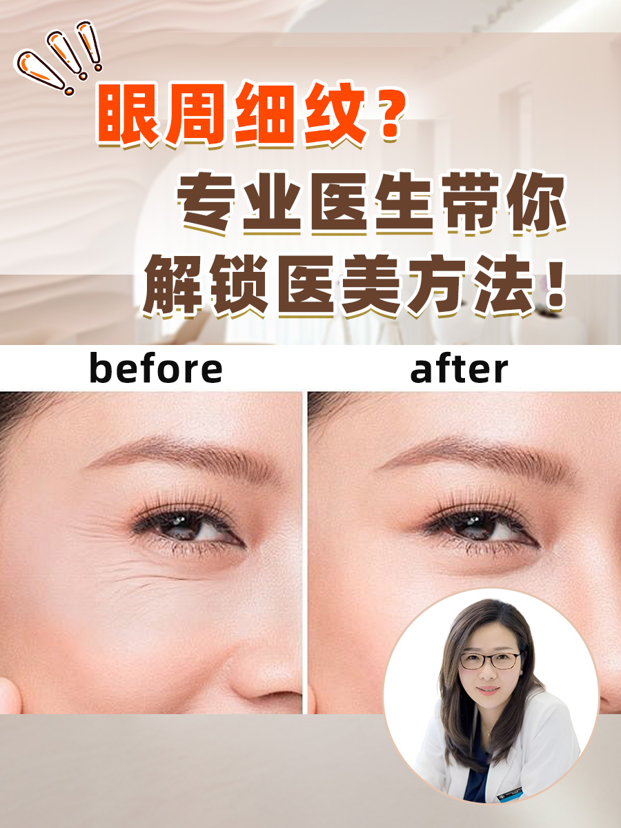 眼周细纹?专业医生带你解锁医美方法!