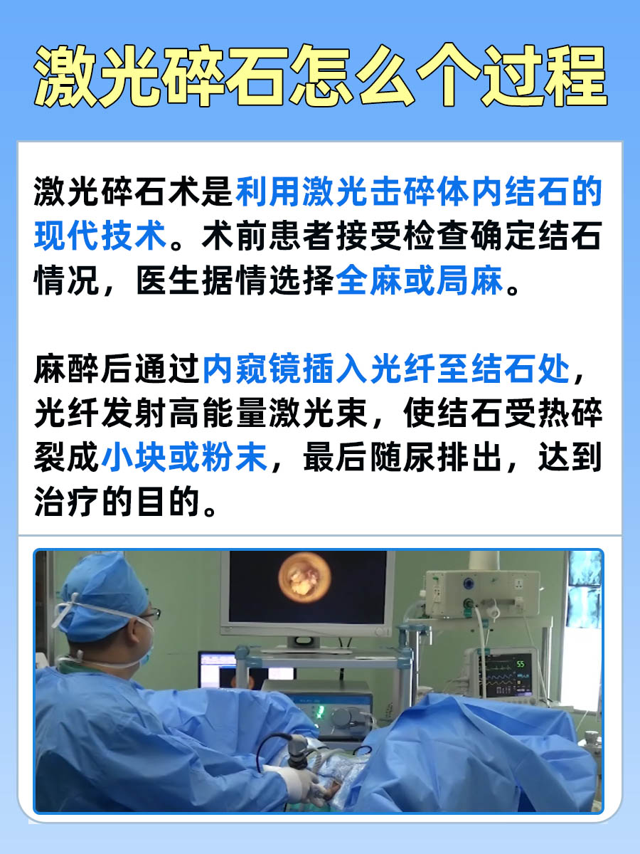 揭秘：激光碎石是怎么个过程