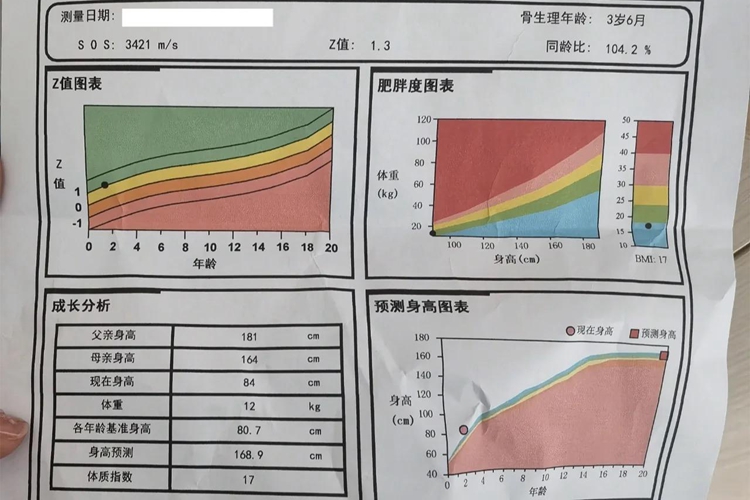 定量超声法骨密度检测报告图