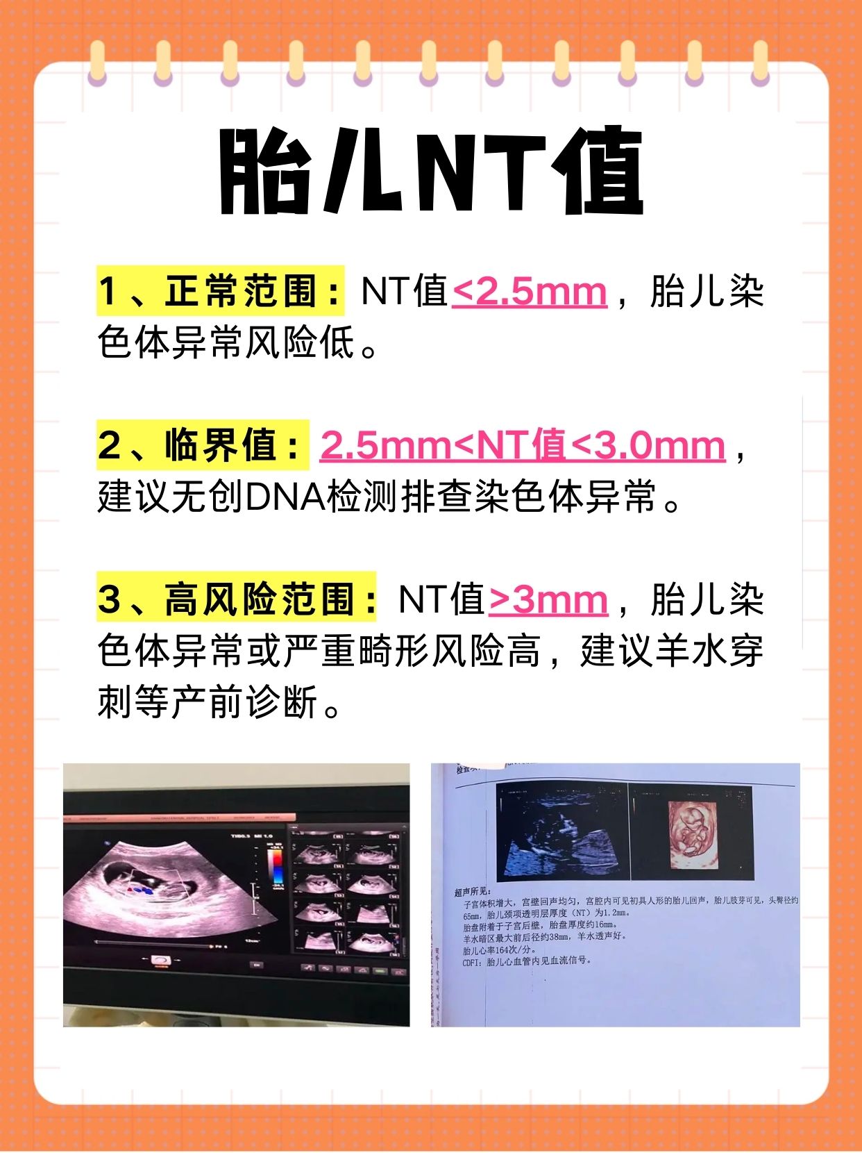 胎儿nt值男女参照表