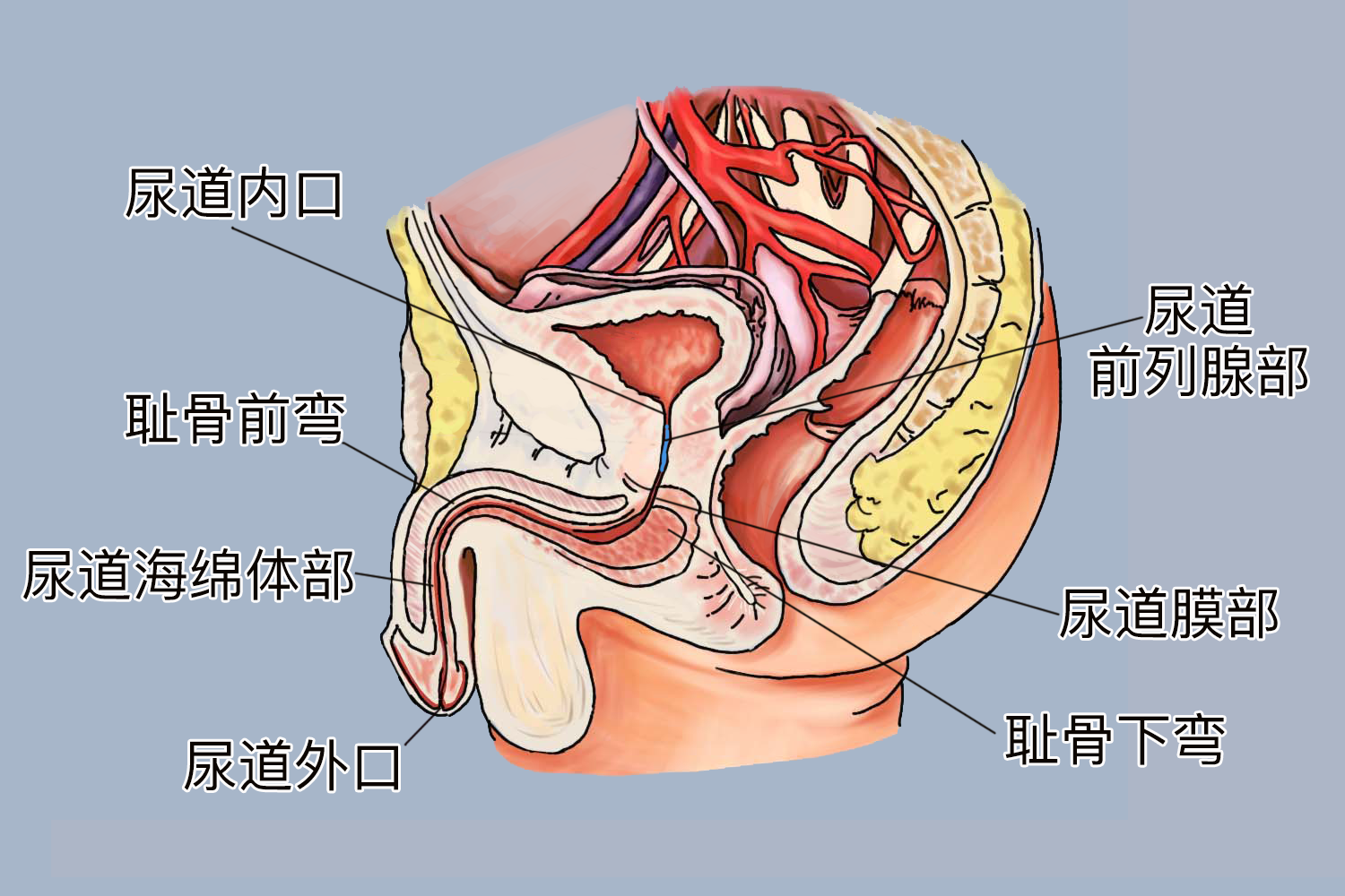 三个狭窄两个弯曲部位图