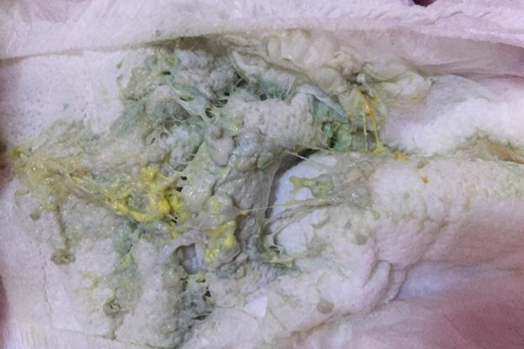 宝宝灰色大便图