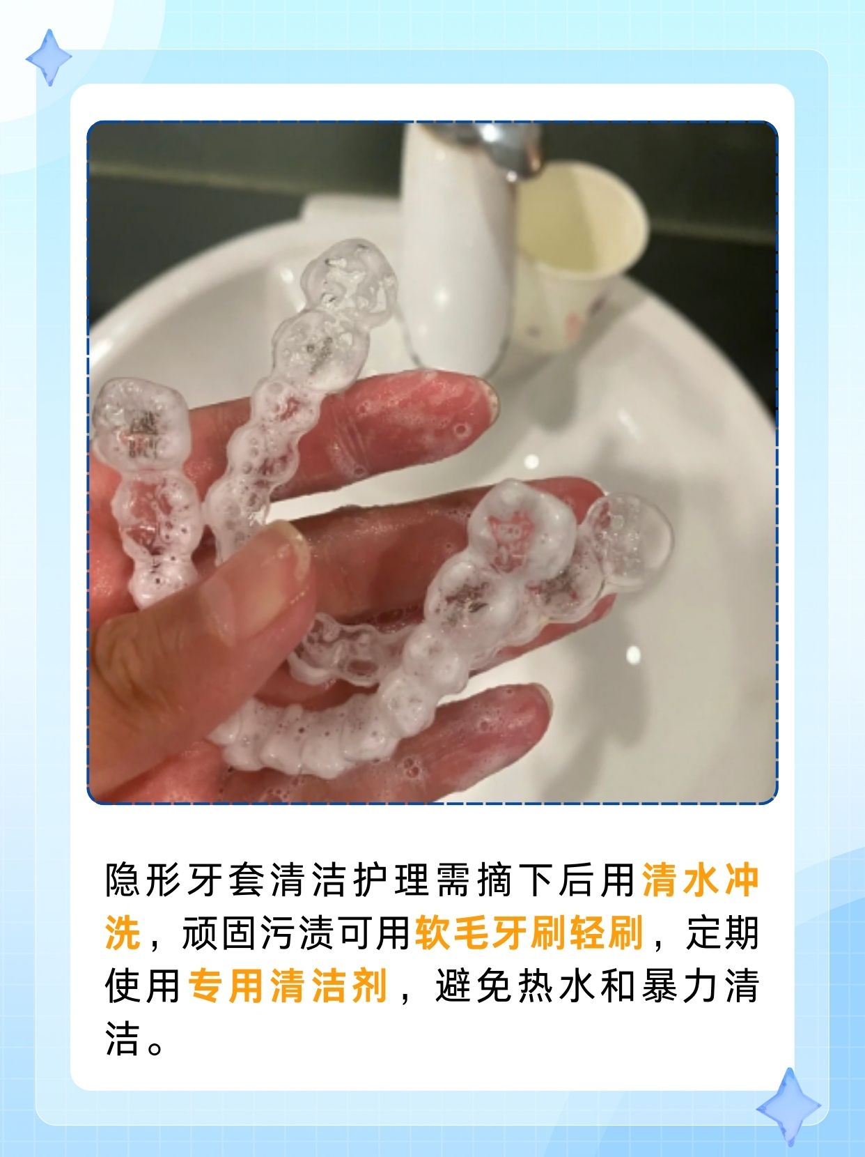 隐形牙套几天换一副，你了解吗？