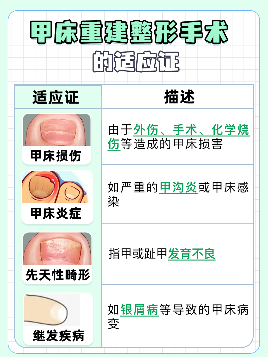 甲床重建整形：打造完美手型，价格是多少？
