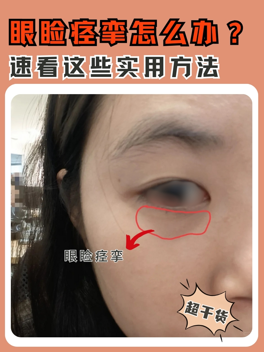 眼睑痉挛怎么办？速看这些实用方法