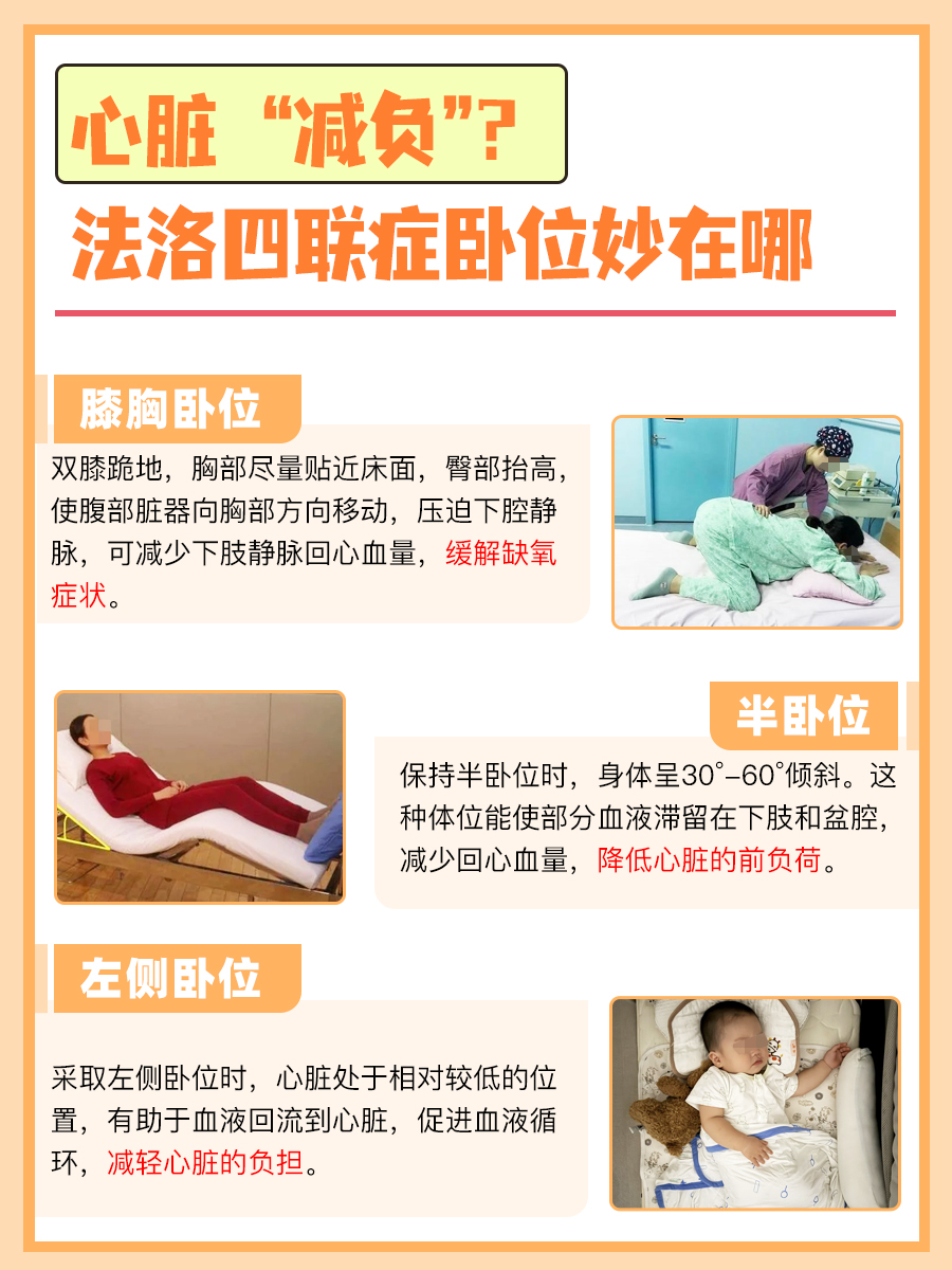 给心脏 “减负”?法洛四联症卧位妙在哪