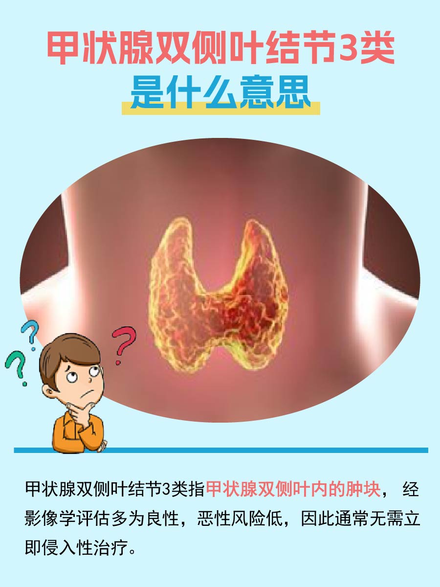 甲状腺小秘密：双侧叶结节3类，你了解多少？