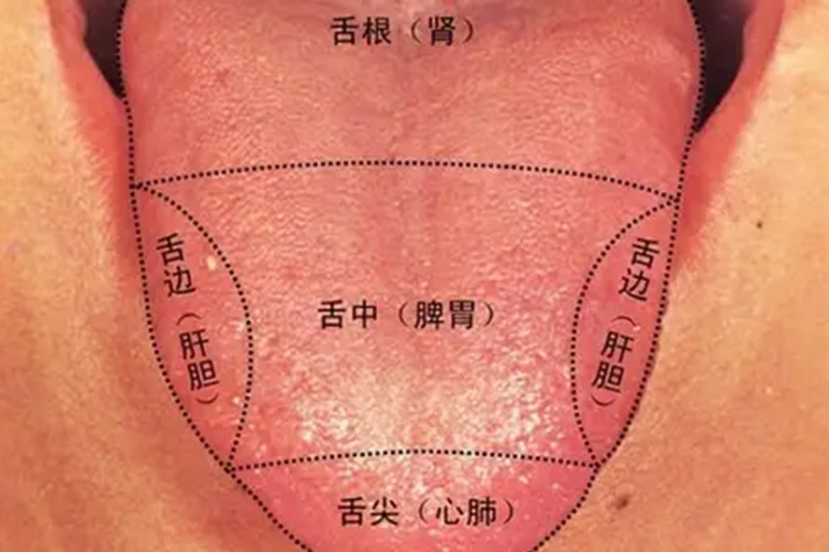 舌面对应身体五脏分区图 舌面对应身体五脏分区图