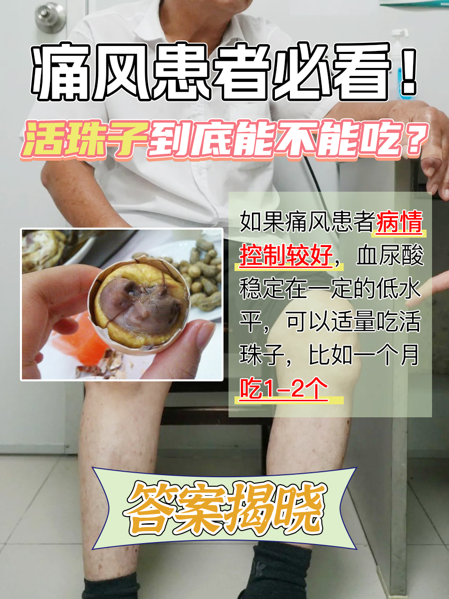 痛风患者必看！活珠子到底能不能吃？答案揭晓