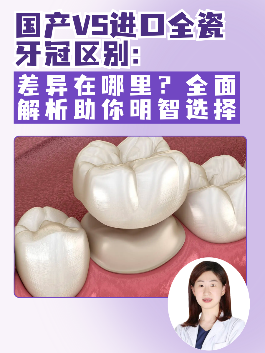 国产VS进口全瓷牙冠区别：差异在哪里？全面解析助你明智选择