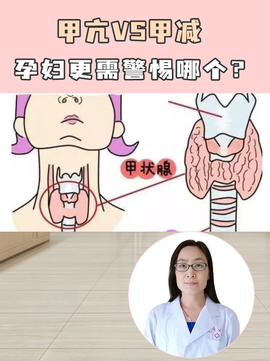 甲亢VS甲减,孕妇更需警惕哪个?