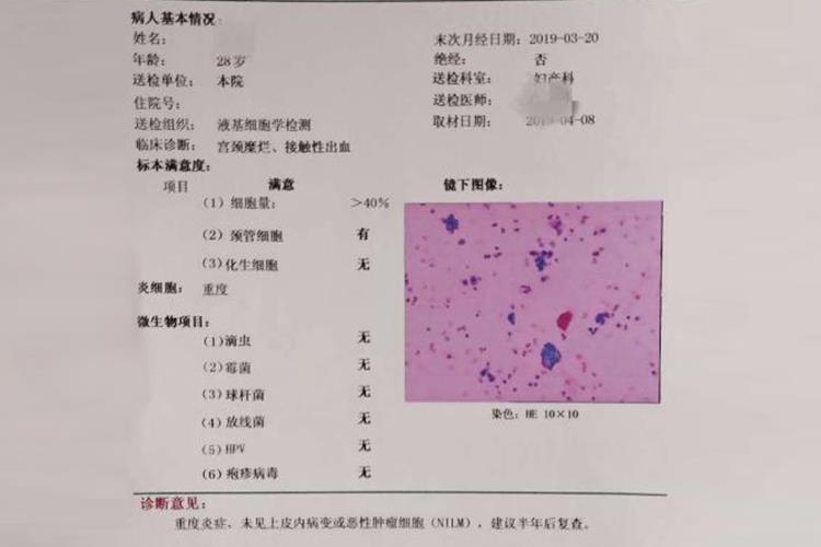 宫颈炎症TCT红色和蓝色分布图