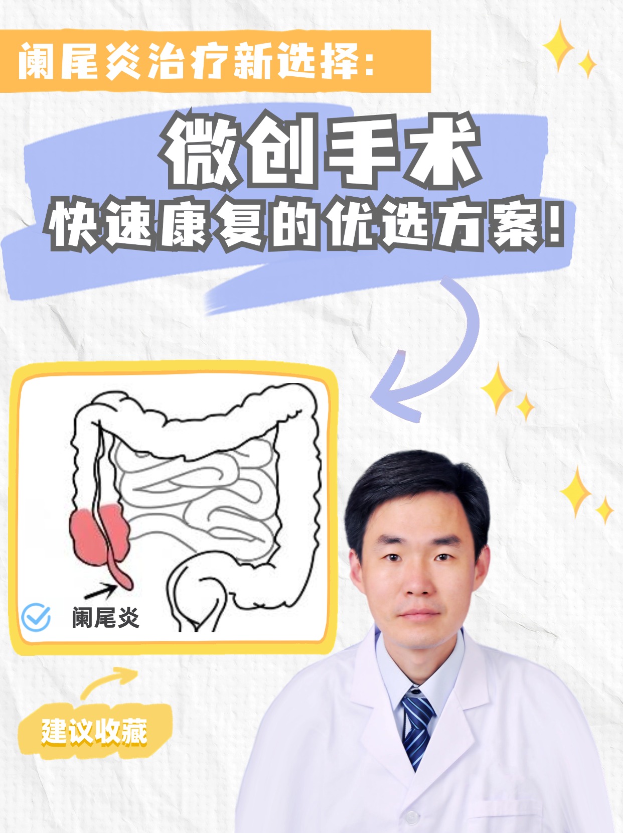 阑尾炎治疗新选择：微创手术，快速康复的优选方案！