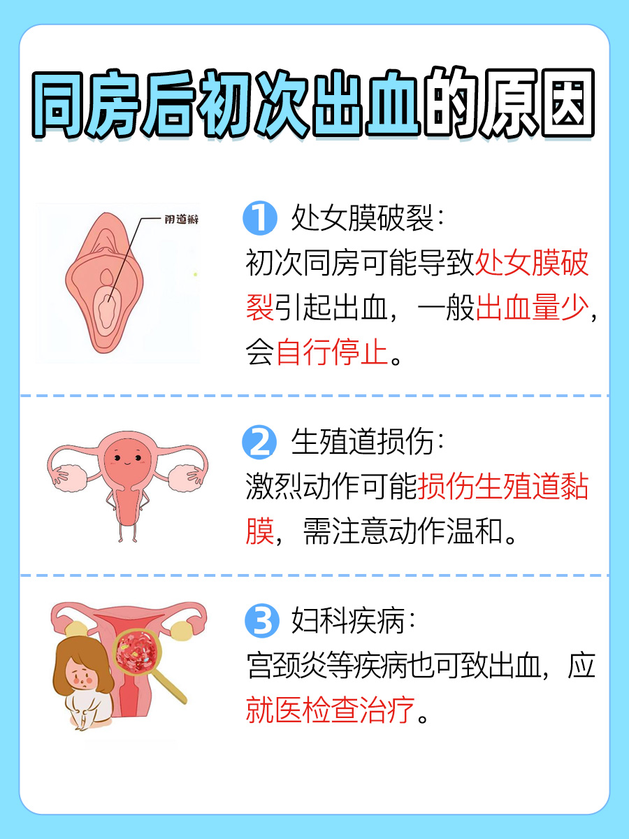 初次同房后出血，医生带你了解原因与应对措施