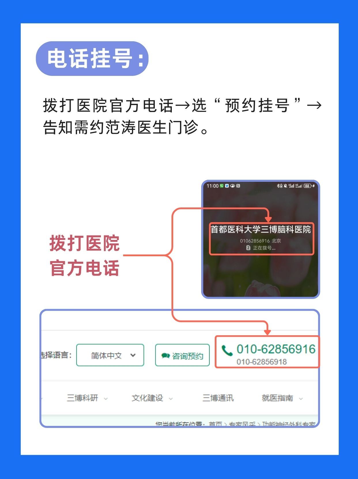 北京三博脑科医院范涛医生怎么样？怎么挂号？