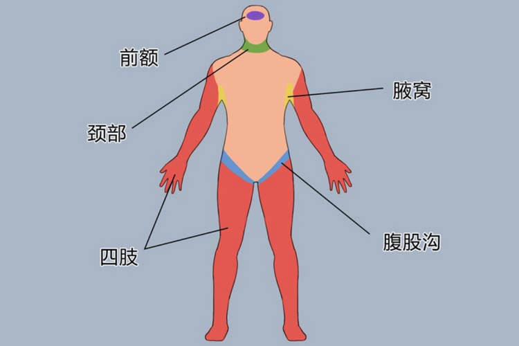 物理降温的正确部位图