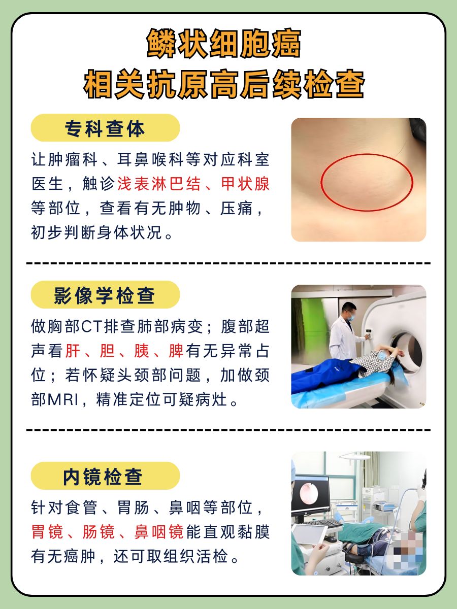 鳞状细胞癌相关抗原高，身体在告诉你什么秘密？