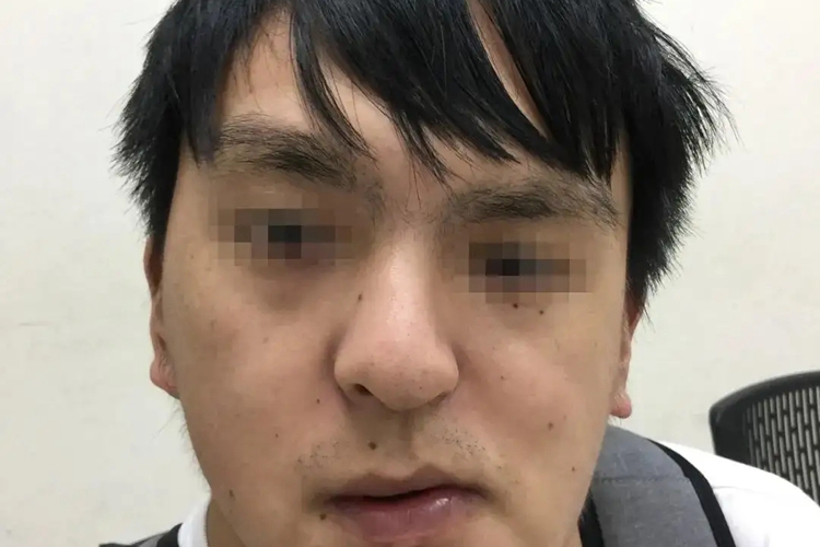 颞下颌关节紊乱图