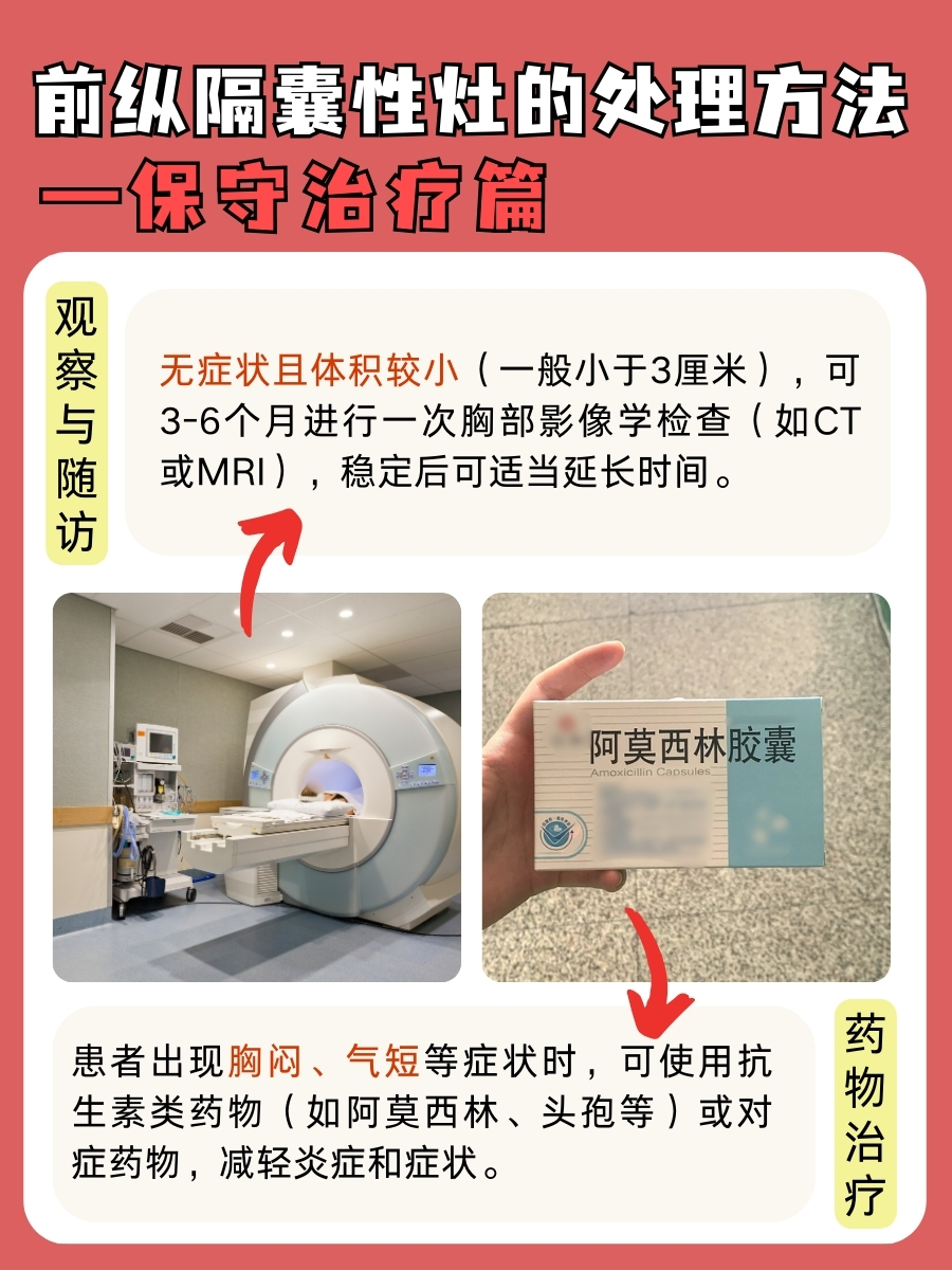 医学新知，前纵隔囊性灶是什么东东？