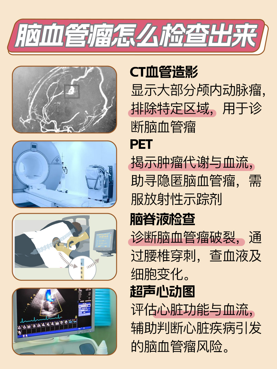 脑血管瘤检查大揭晓!这些检测手段你必须知道