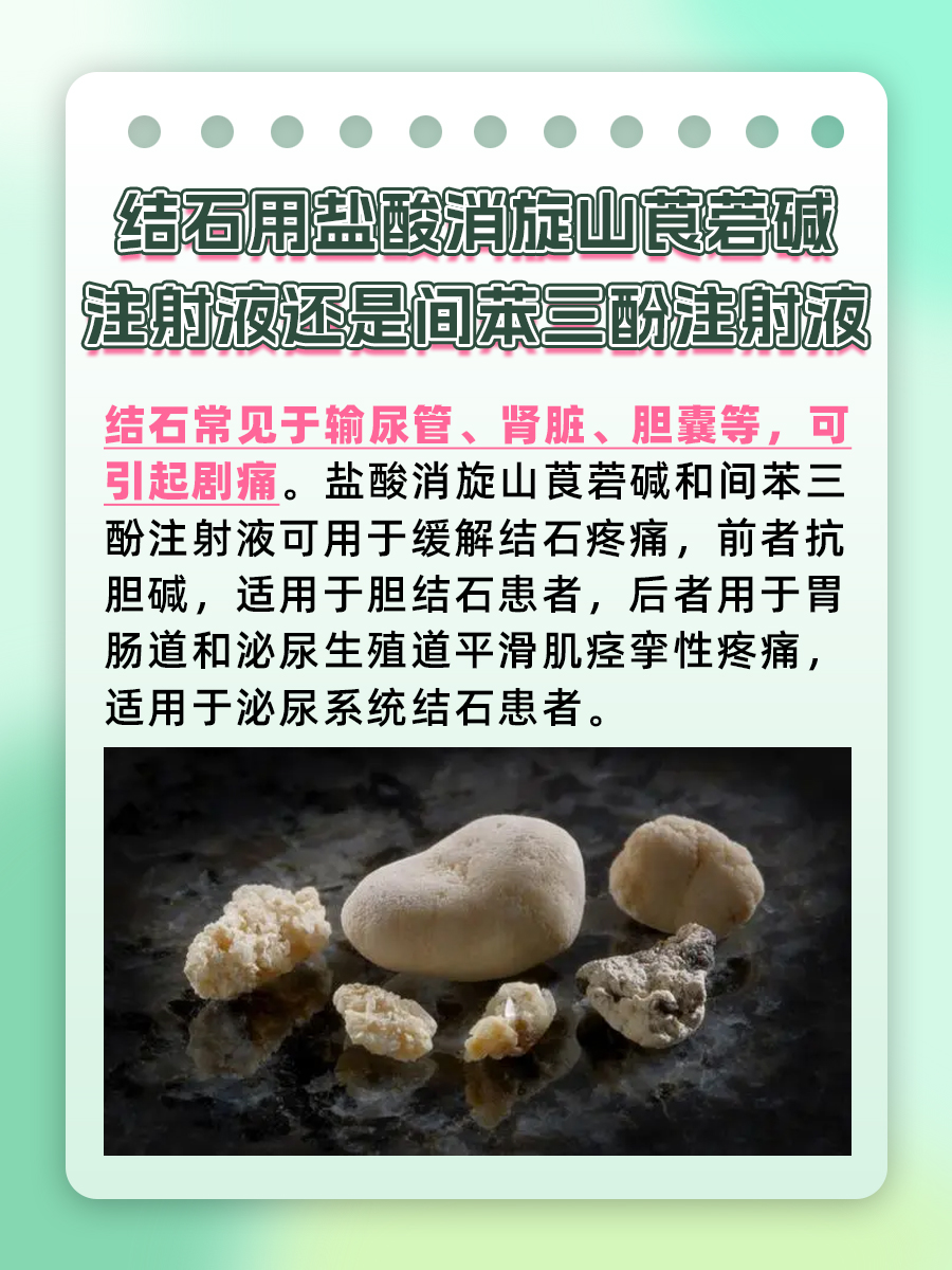 结石治疗选择:6542与间苯三酚的对比