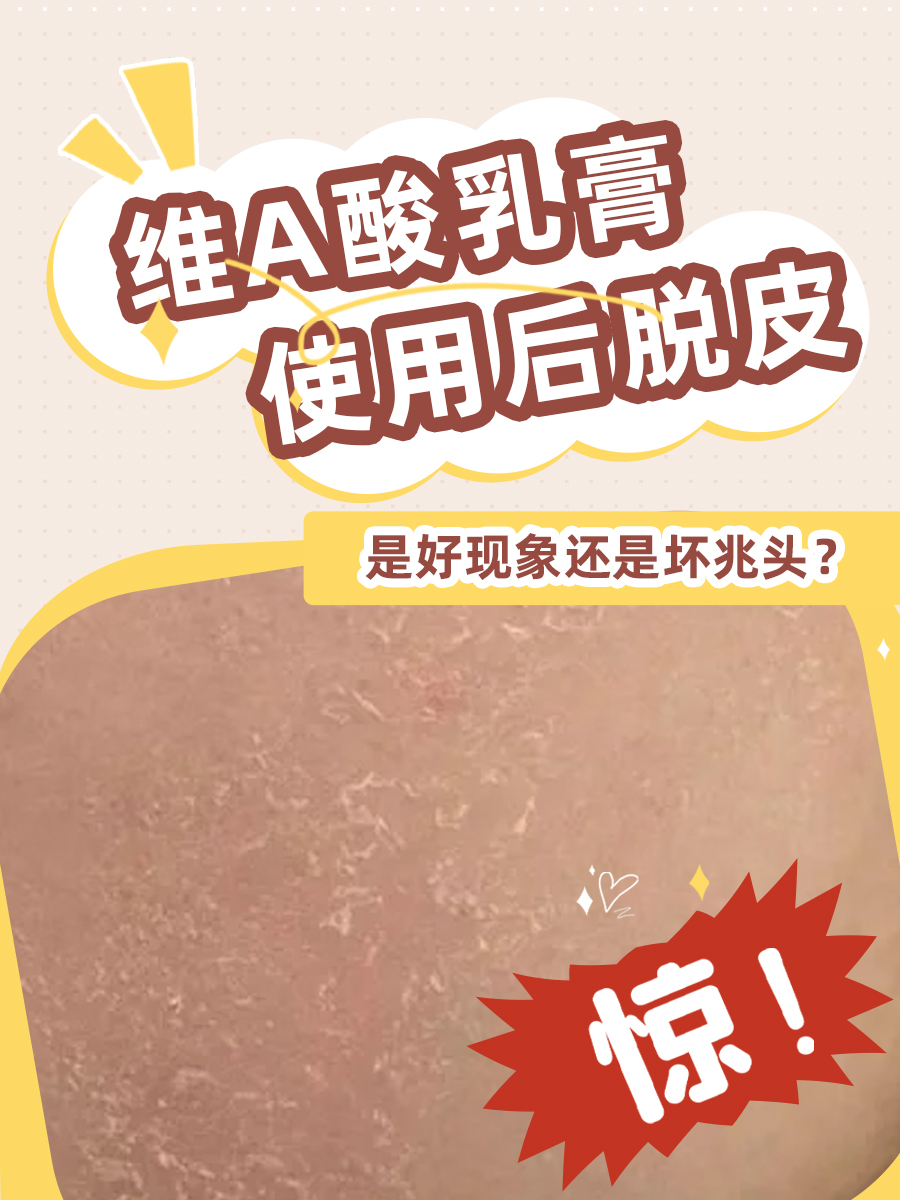 维A酸乳膏使用后脱皮，是好现象还是坏兆头？