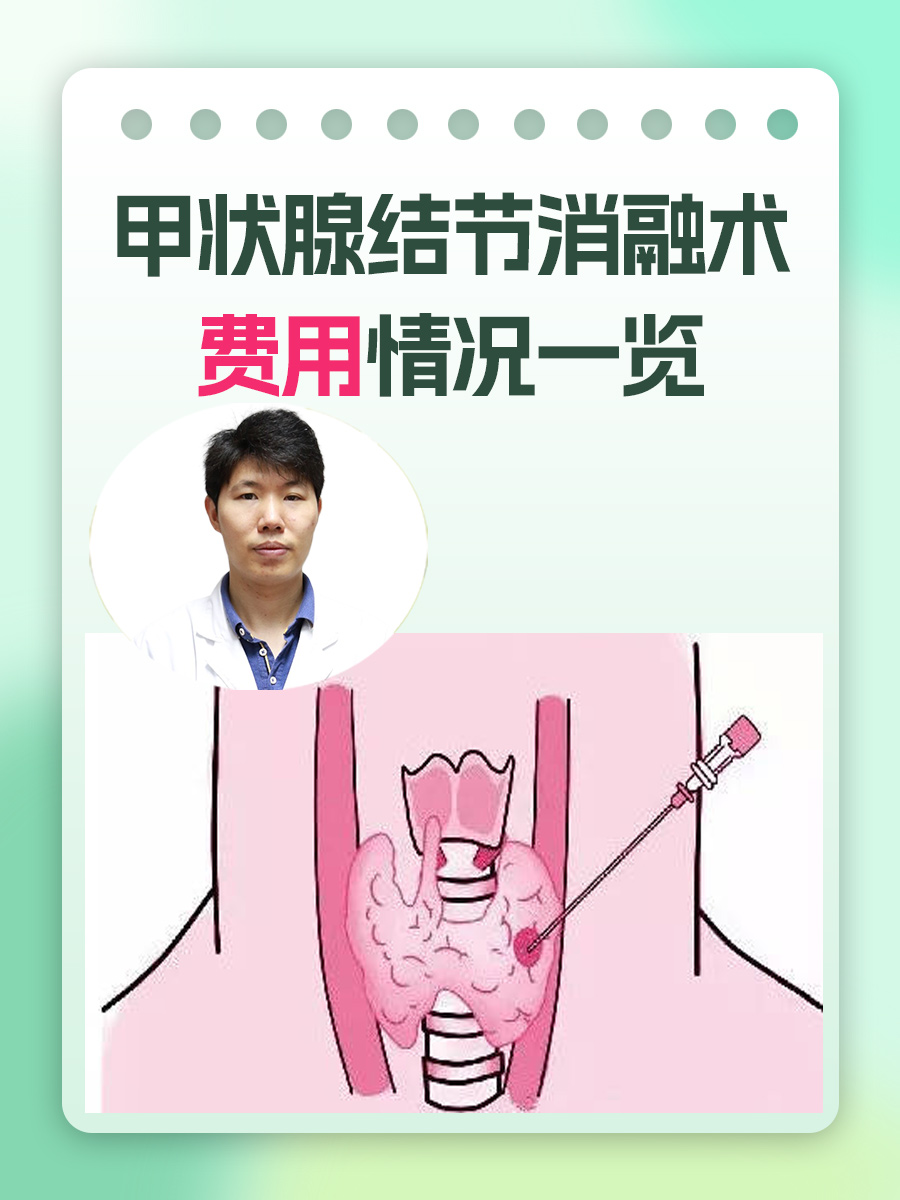 甲状腺结节消融术：费用情况一览？