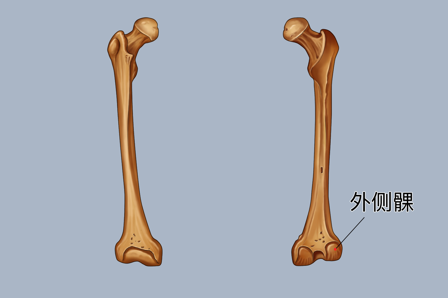 股骨外髁图 股骨外髁图