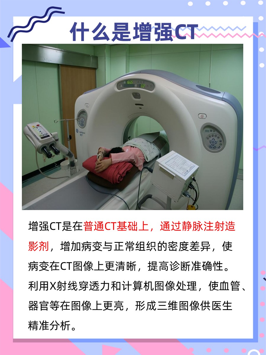 这篇文章带你了解，什么是增强CT