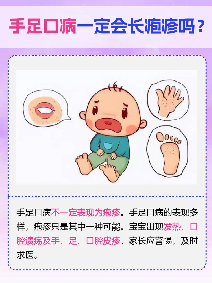 手足口病是否必然伴随疱疹?家长须知