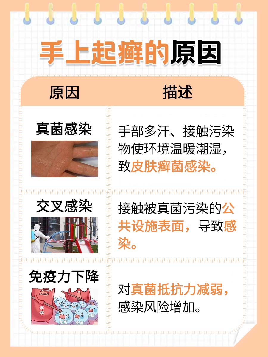手上起癣是怎么引起的，真相大揭秘