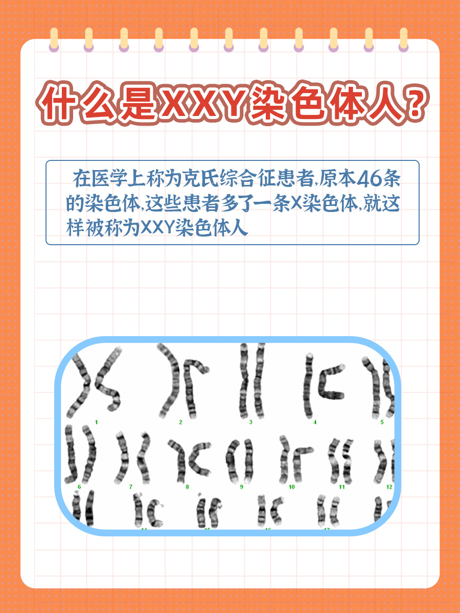 XXY染色体人:与众不同的体征解析