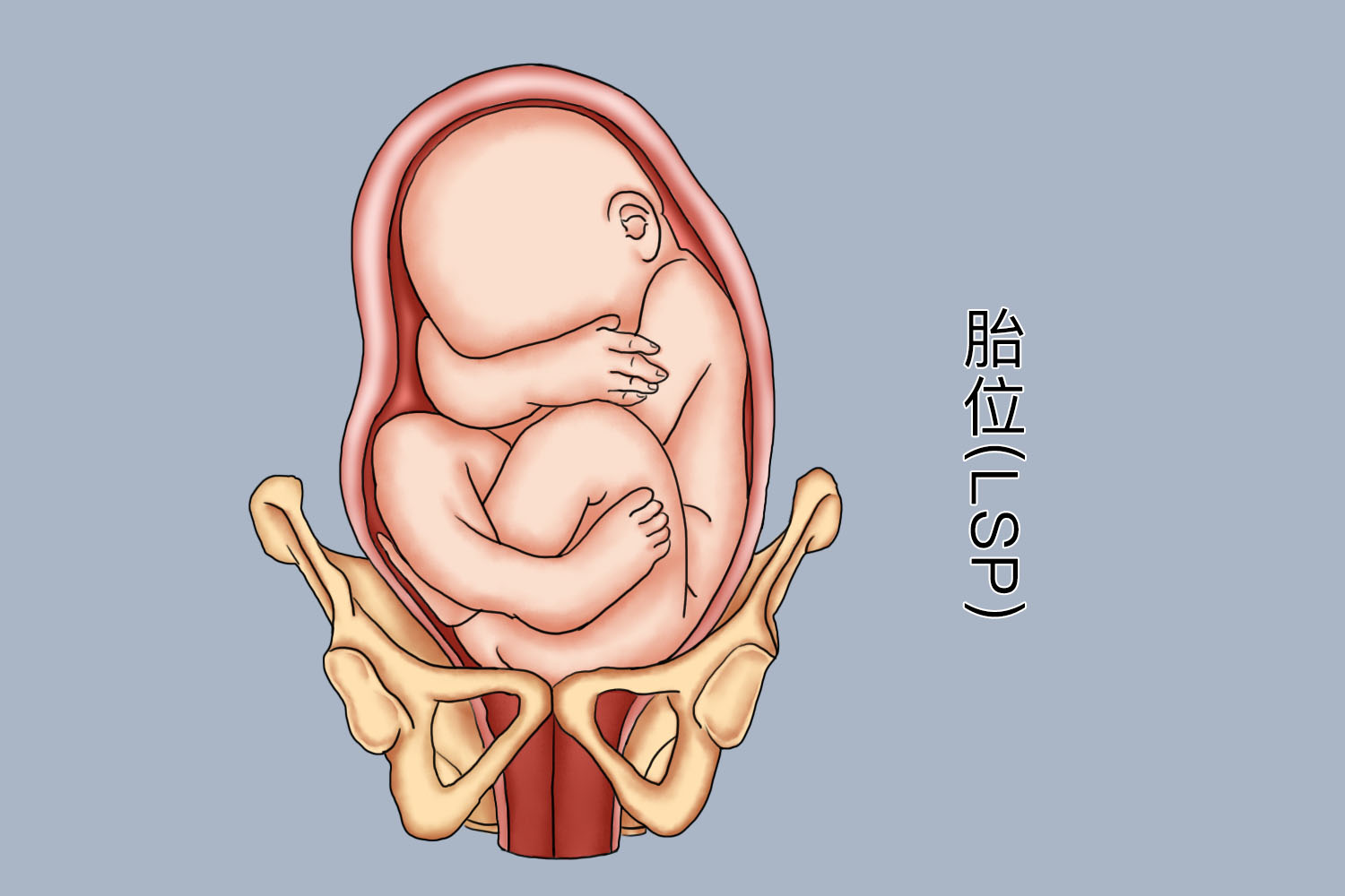 胎位LSP图
