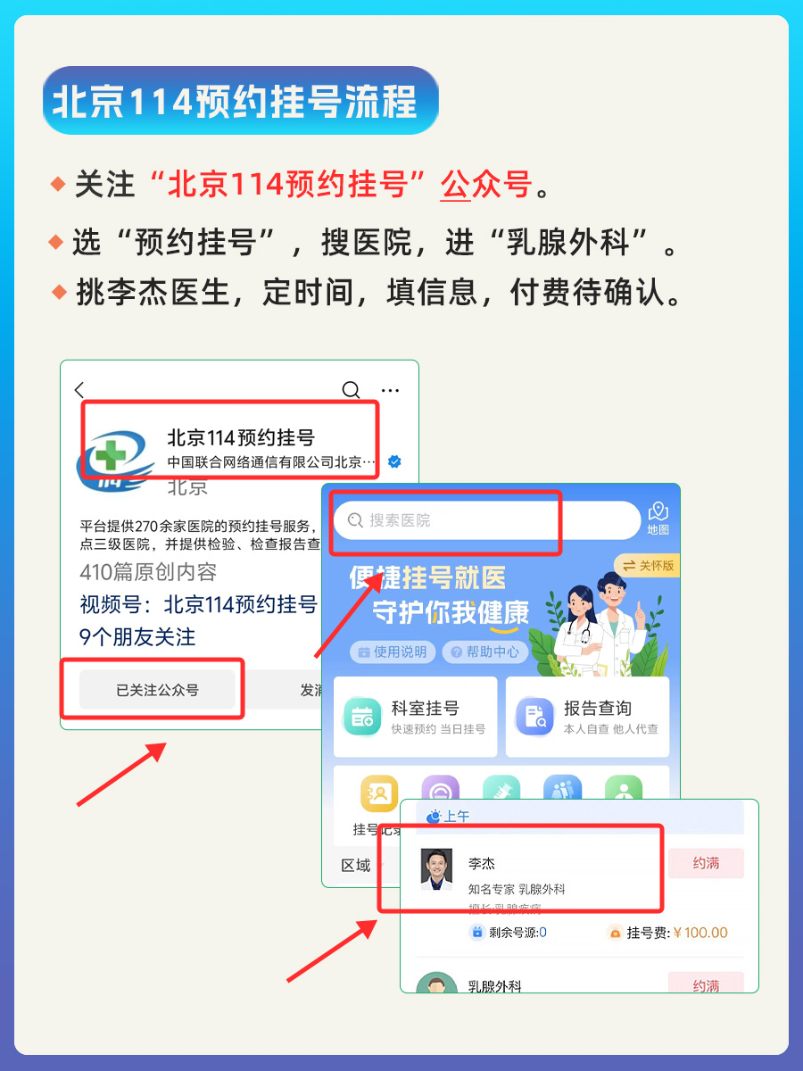 北京朝阳医院李杰医生怎么样？怎么挂号？