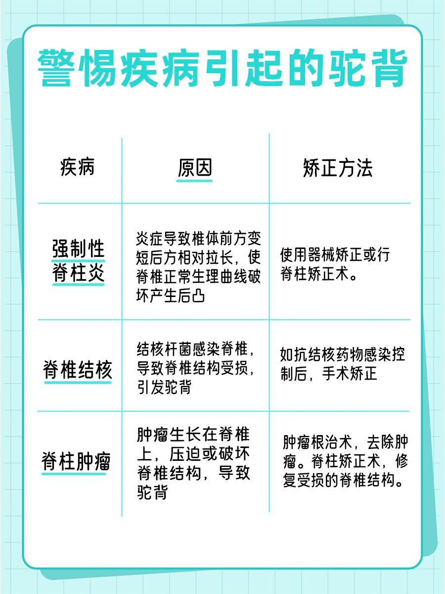 告别驼背，3个动作助你挺拔身姿
