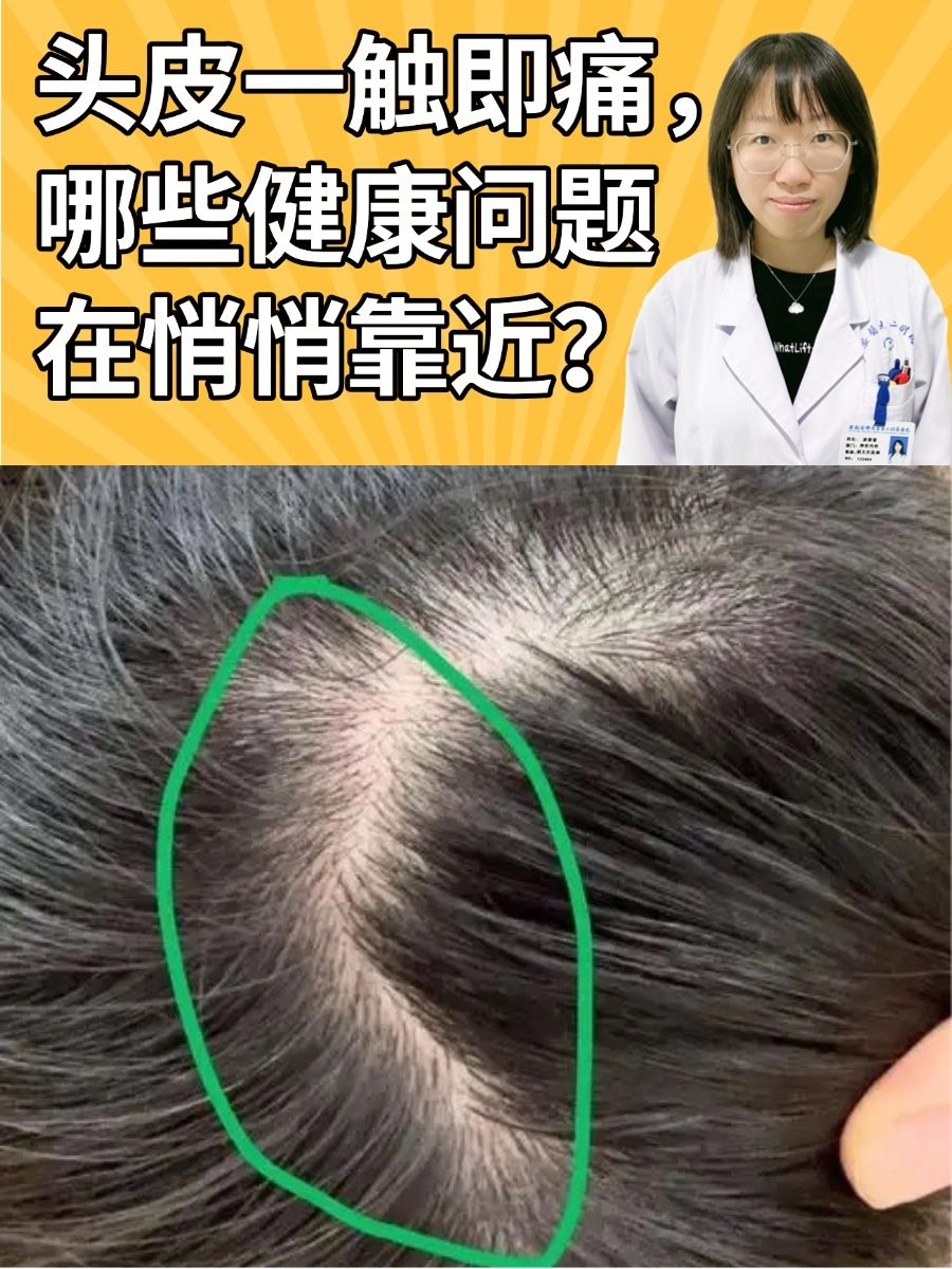 头皮一触即痛,哪些健康问题在悄悄靠近?