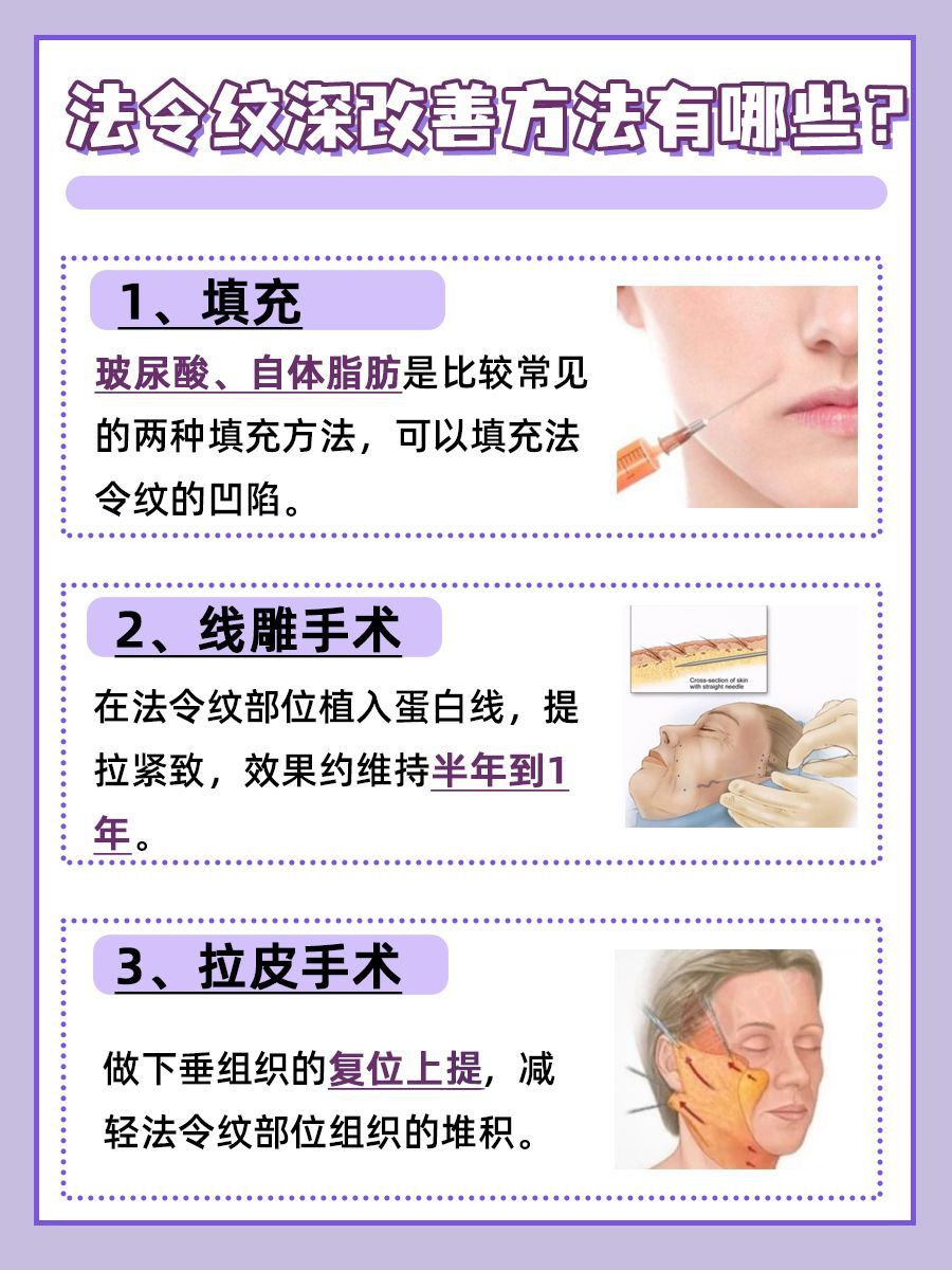 法令纹深:医生教你这几招帮你轻松解决