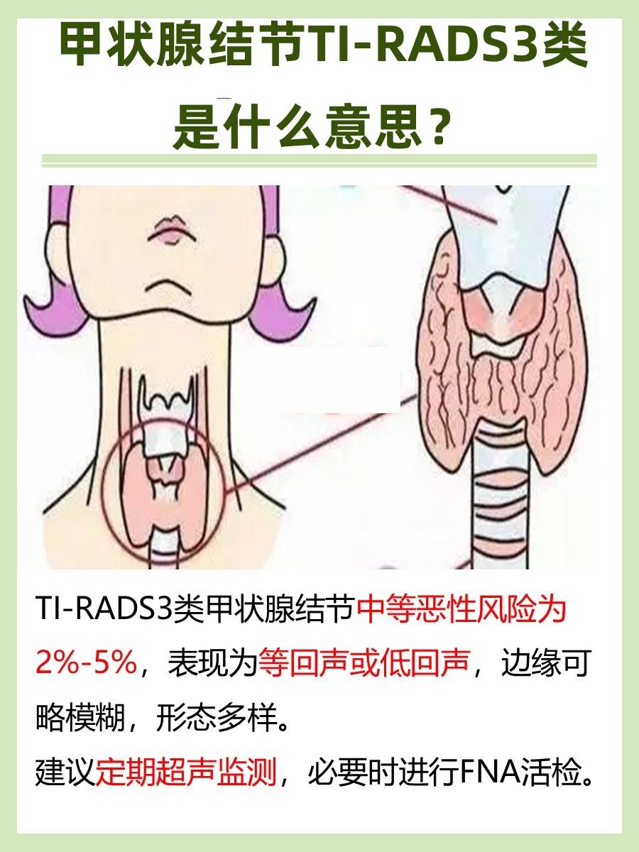 甲状腺结节TI-RADS3类解读，需知！