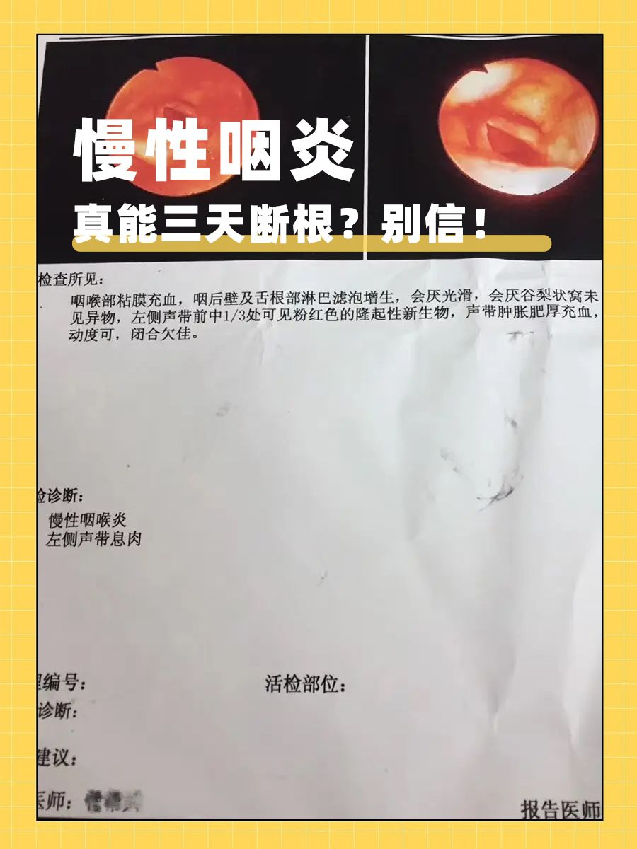 慢性咽炎真能三天断根？别信！