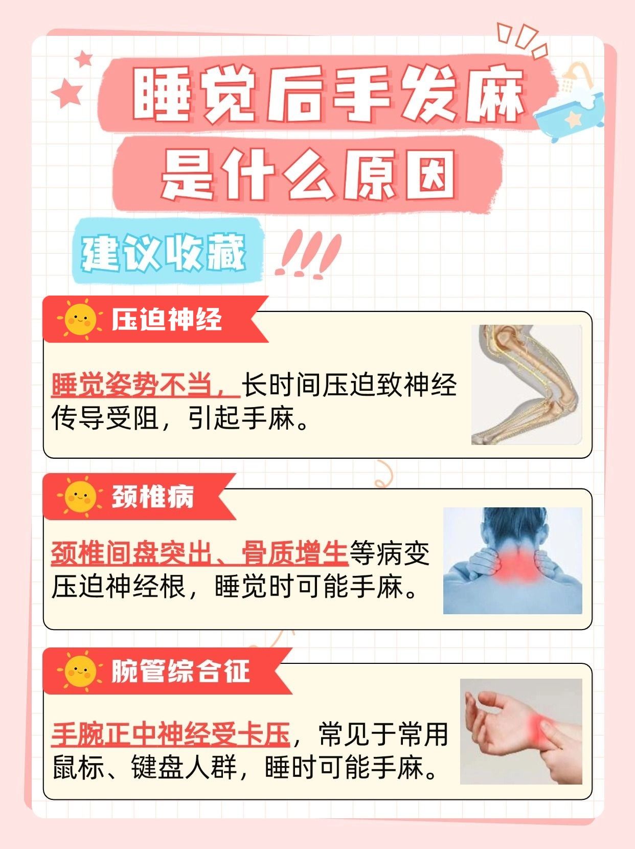 睡觉后手发麻,究竟是何缘由