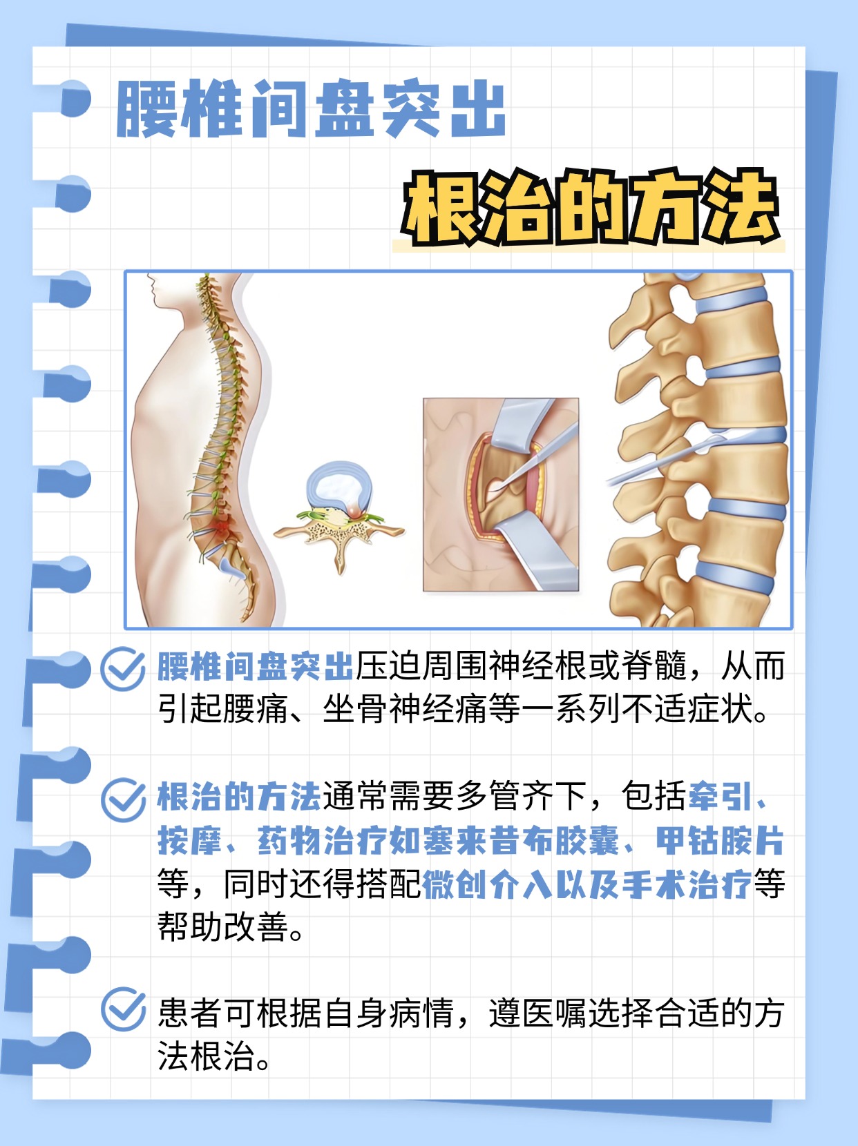 腰间盘突出的根治之道：专业视角的深度解析