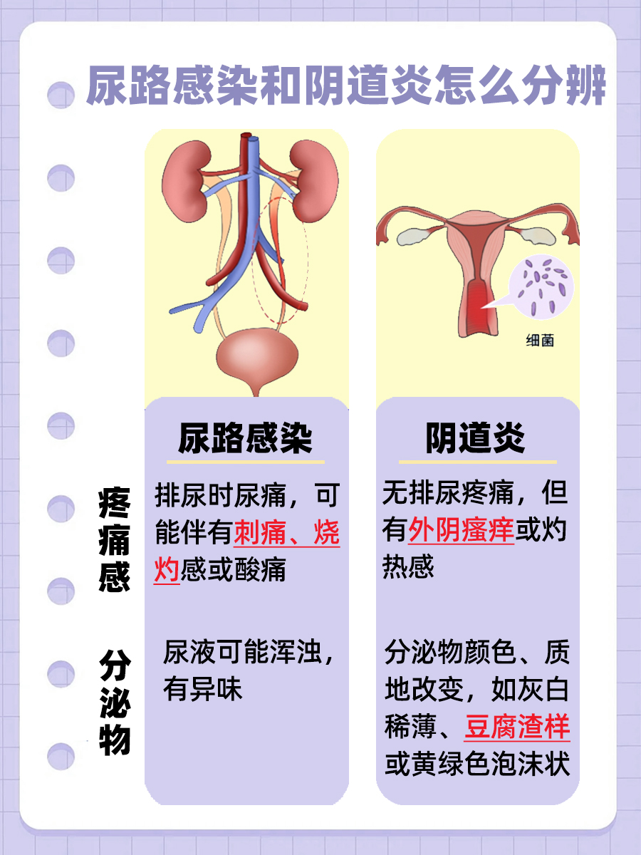 如何区分：尿路感染与阴道炎