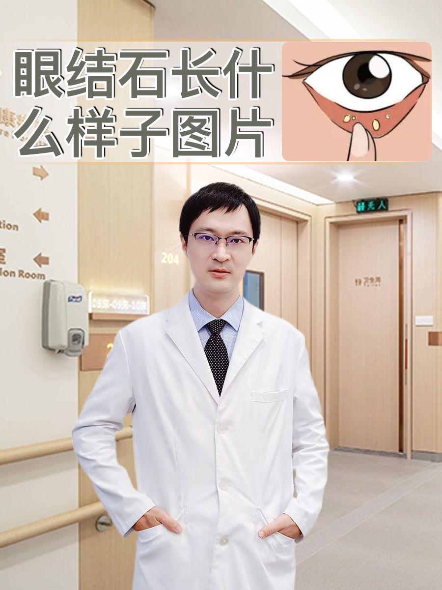 眼结石长什么样子图片